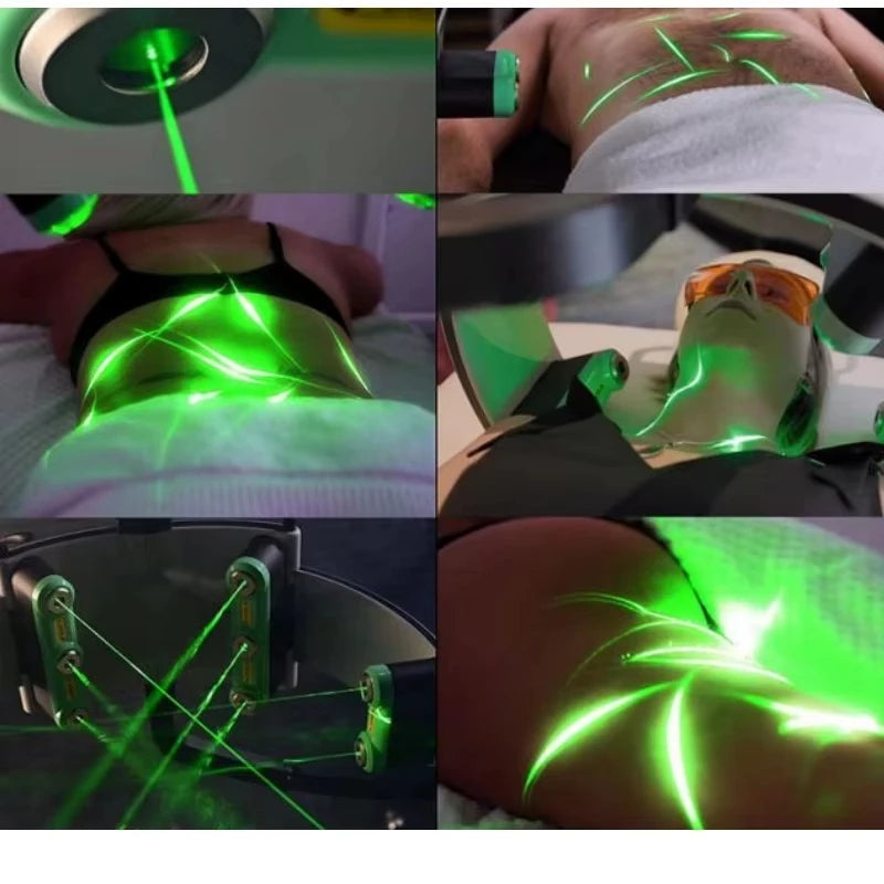 GIOIO Laser Painless 532nm Fat Loss Body Shaping
