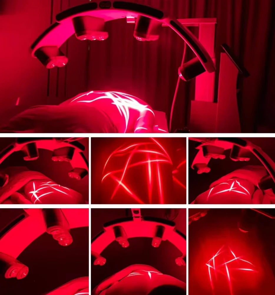 GIOIO Laser Painless 532nm Fat Loss Body Shaping